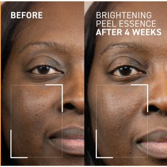 DR. BRANDT dr b labs BRIGHTENING PEEL ESSENCE - Picture 5 of 6